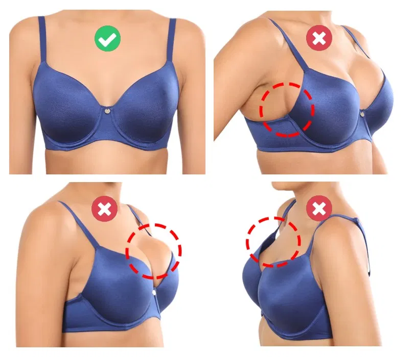 problems with bra cup fitting